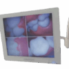SET DE MONITOR Y CAMARA INTRAORAL ODONTUM