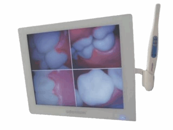 SET DE MONITOR Y CAMARA INTRAORAL ODONTUM